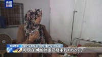 觸目驚心 加沙14歲營(yíng)養(yǎng)不良少年體重僅有10公斤