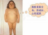向心性肥胖怎么辦
