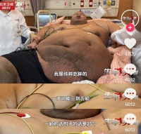 33歲小伙體重一度超700斤，躺貨車進(jìn)京求醫(yī)，近半年減重300多斤！