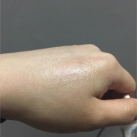 疤痕膏配方加工工藝技術(shù)制作方法