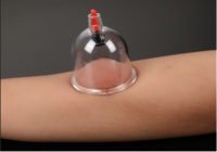 【科普讲堂】生活中的安全用械科普——拔罐