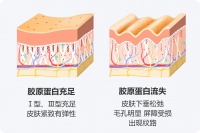 人瘦了胶原蛋白会流失吗