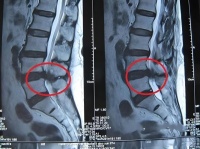 正确认识疼痛信号：健康生活的重要环节