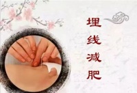 【名术天工集】济南市中西医结合医院穴位埋线减肥疗法：绿色瘦身 让美丽不设限