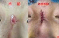 曾经一张缝合图遭 21 万同行怒批：草菅人命！患者术后 7 个月恢复却让人惊掉下巴