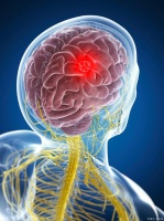 懂得：癫痫患者在日常生活中如何保持健康的社交活动与稳定的人际关系。