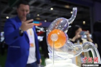 中国社会热议体重管理缘于对健康生活方式的追求