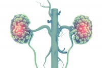 肾结石疼起来怎么缓解（实用生活技巧推荐）