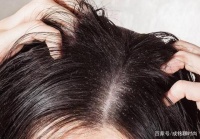 去油容易控油難，學(xué)會(huì)這三種小妙招，讓你頭皮清爽還能預(yù)防掉發(fā)