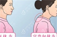 吉林市去富貴包大概多少錢？抽脂術(shù)5000+切除術(shù)1w+微創(chuàng)吸脂1w+特色手術(shù)2w+