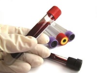 糖尿病人糖化血紅蛋白6.5，為啥比空腹血糖6.1還高卻是正常的？
