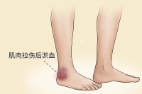 经常跑步的好处和坏处