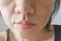 脱水对健康的影响与阶段详解