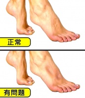 自我健康檢測指南：發(fā)現(xiàn)身體問題的早期信號