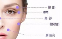 分憂(yōu)解難：做一次線(xiàn)雕能維持幾年？線(xiàn)雕消失后會(huì)不會(huì)更老？