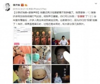 每天甩手5分鐘，疾病都帶走！李開復(fù)用它抗癌，沒想到效果這么好！