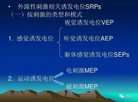 腦誘發(fā)電位5大分類，一文盤點！