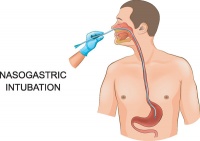糖塊卡在食道里怎么辦