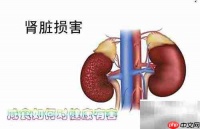 咸食过量危害健康