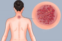 什么食物去除體內(nèi)濕氣最好