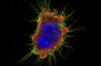 UCLA Health｜脑癌治疗新趋势：放疗+诊疗一体化