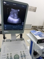 为手术刀装上“实时导航”：当术中超声成为妇科医生的“第二双眼”