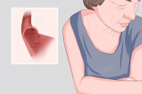 糖尿病酮癥什么原因