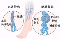 【健康知识进万家】冬天泡脚好处多 注意事项别忽略