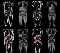 揭秘健康体型的科学标准：如何通过腰围、大腿及臀部优化健康