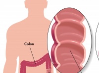 肠胃不好可以怎么办