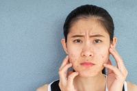 脸上长这种痘痘用手不小心扣破了怎么办