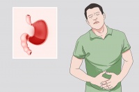 胃酸分泌过多怎么解决