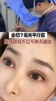 广州荔医整形美容价格表：双眼皮4000起，隆鼻15712起，美杜莎眼综合9800起！