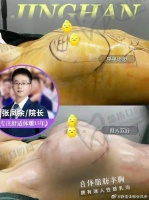 广州军美吴国勇个人简介曝光，脂肪种植胸技术宣称存活率70%