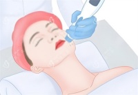 韩国面部吸脂全解析：想拥有精致小脸？这份价格攻略必须收藏！