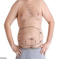 腹部整形手术需要多少钱