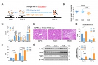 清華大學藥學院王釗課題組報道 高淀粉飲食加重非酒精性脂肪肝的新機制