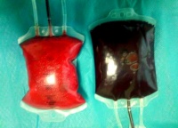 三氧大自血療法：亞健康人群的新希望與應(yīng)用揭秘