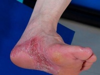 警惕精神疾病風(fēng)險：全面評估嚴(yán)重性的七大關(guān)鍵指標(biāo)