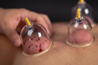 拔罐減肥的工作原理是什么 哪些人群不宜用拔火罐法減肥→榜中榜知識