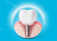 兰溪种植牙价格大揭秘!从3000到20000元,你的笑容值多少?