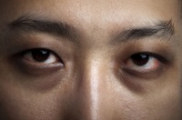 肾阴虚引起的黑眼圈和身体消瘦能恢复么