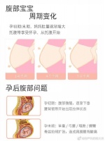 无痛分娩导致腰痛？其实是产前准备工作未做好