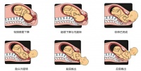 【科普】自然分娩：生命与爱的智慧之旅