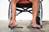 侏儒症患者能活多久