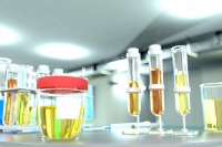 如何根据尿尿颜色分辨健康状况