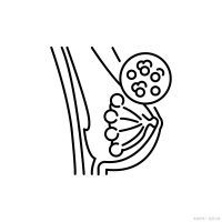 哺乳期乳房红肿热痛？小心是乳腺炎在“捣乱”