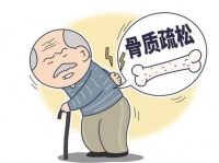 “骨”舞指南 防治骨质疏松
