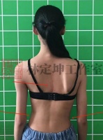开学大检查！孩子身体“不对称”？可能是“特发性脊柱侧弯”发出的信号！