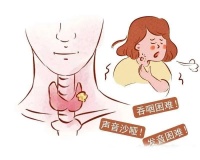 甲状腺癌护理全攻略——从饮食、运动到心理调适，全方位呵护您的健康！